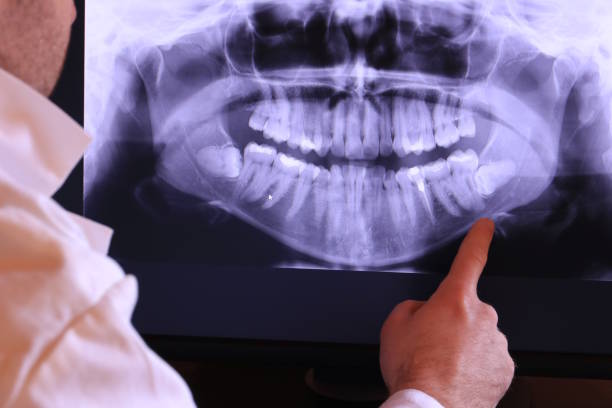 Best Tooth Pain Emergency Relief  in Brookville, PA